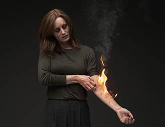 A woman with simulated atopic dermatitis gazes downward and scratches a diffuse lesion on her left arm